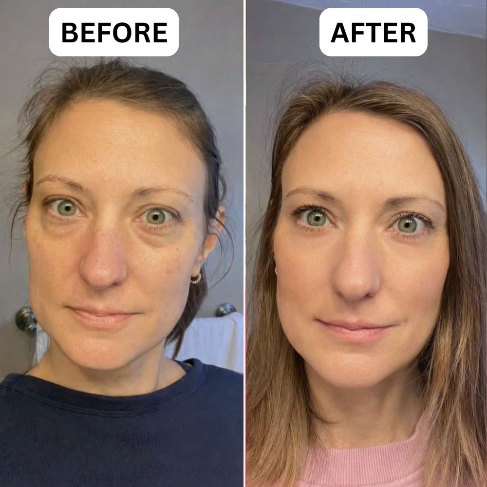 dermatologist approved under eye patch for wrinkles and dark circles