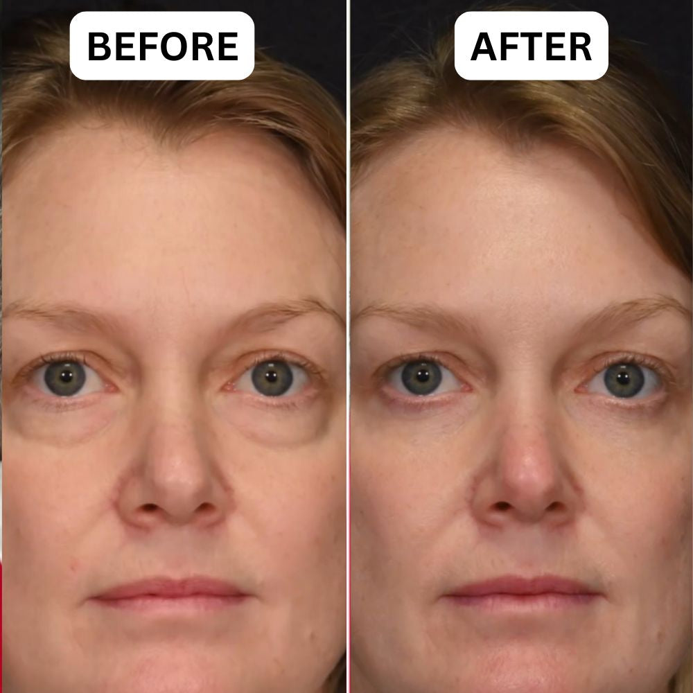 dermatologist approved under eye patch for wrinkles and dark circles