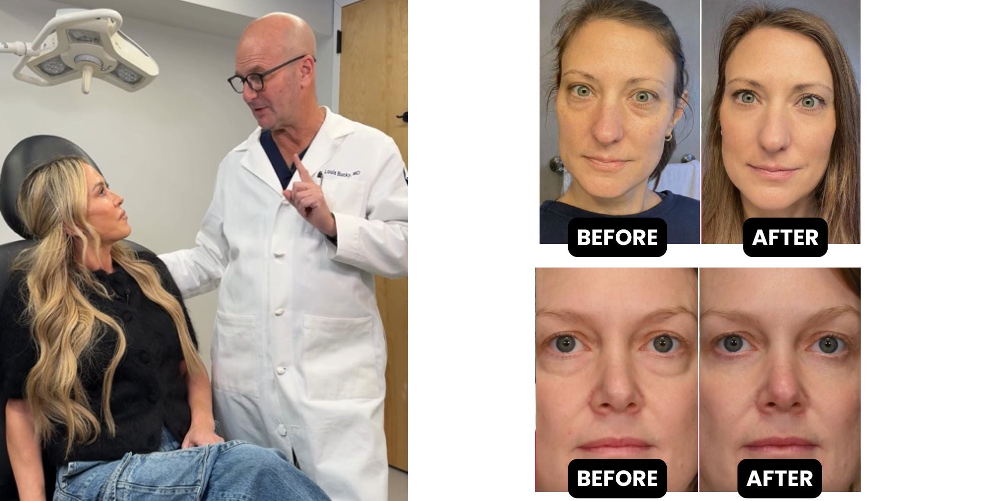 Dermatologist-approved Eye Patches for wrinkles, puffiness and dark circles