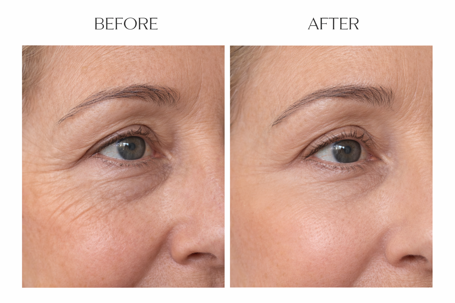 Dermatologist-approved Eye Patches for wrinkles, puffiness and dark circles
