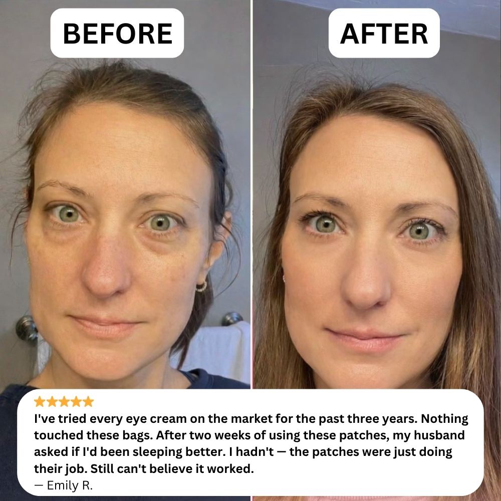 NOVELIA Microneedle Patches