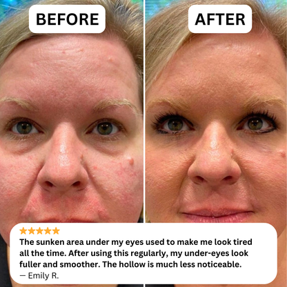 NOVELIA Microneedle Patches