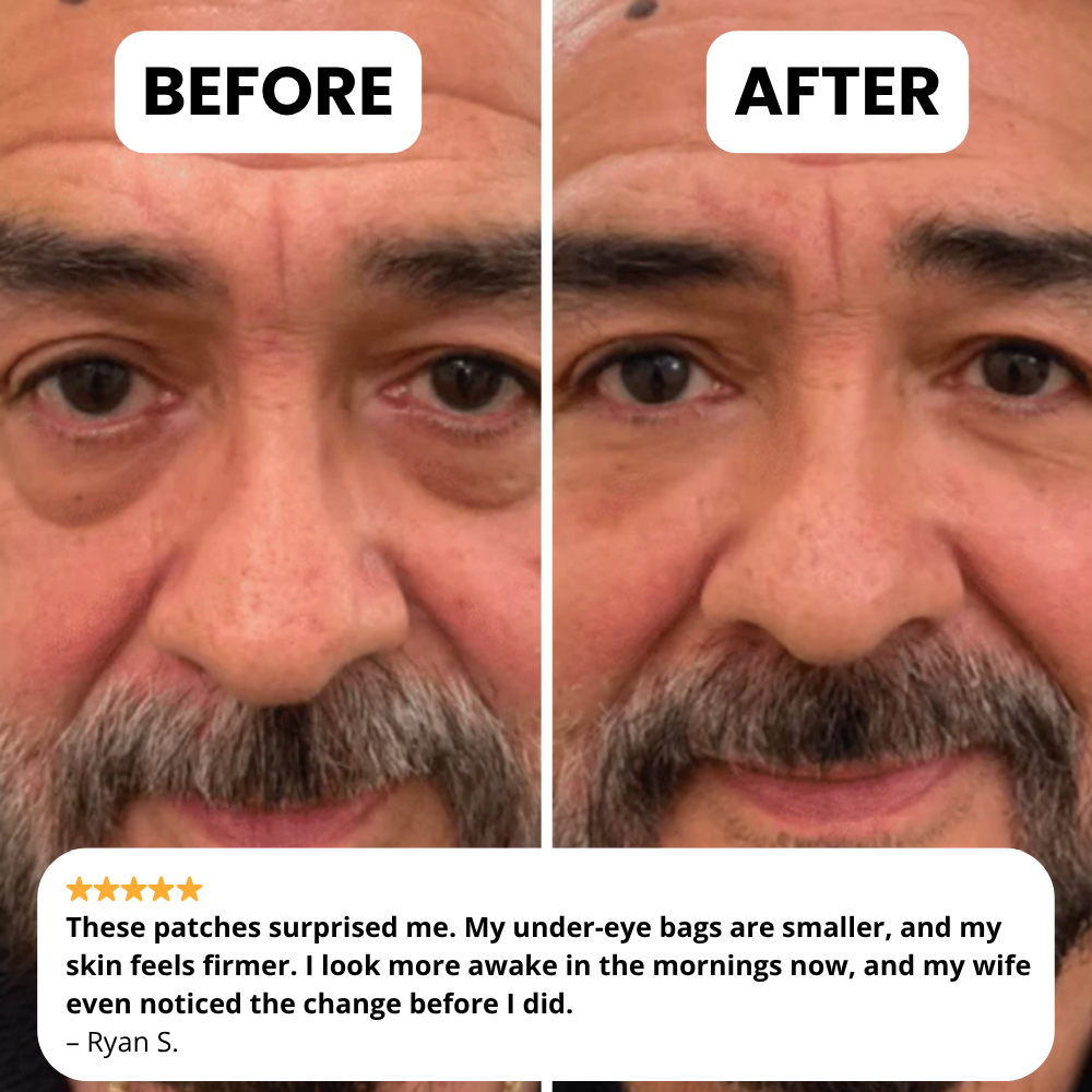 Novelia - Microneedle Patches