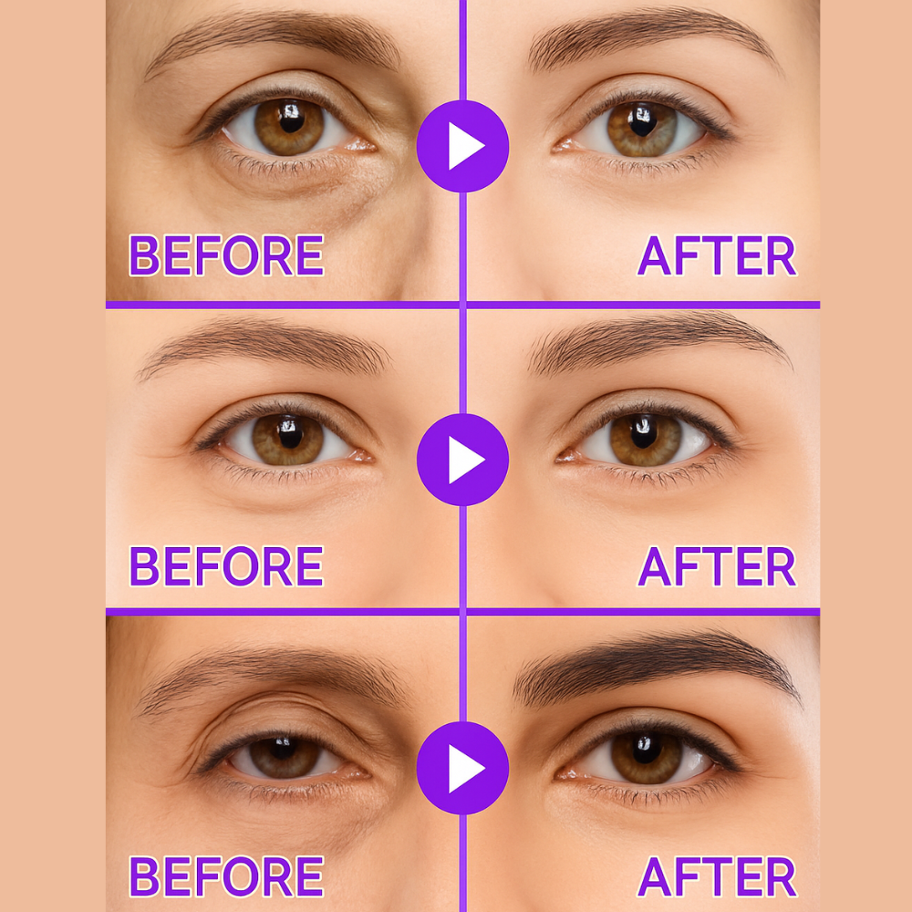 NOVELIA Microneedle Patches