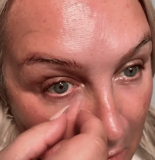 Applying a Novelia under-eye patch